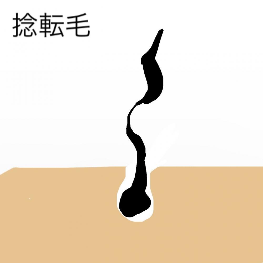 ②捻転毛・ねんてんもう