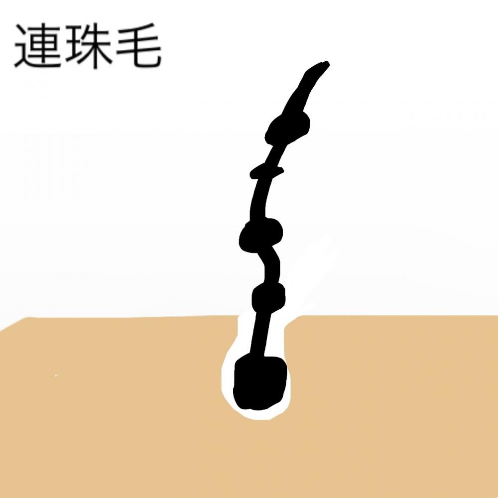 ③連珠毛・れんじゅもう