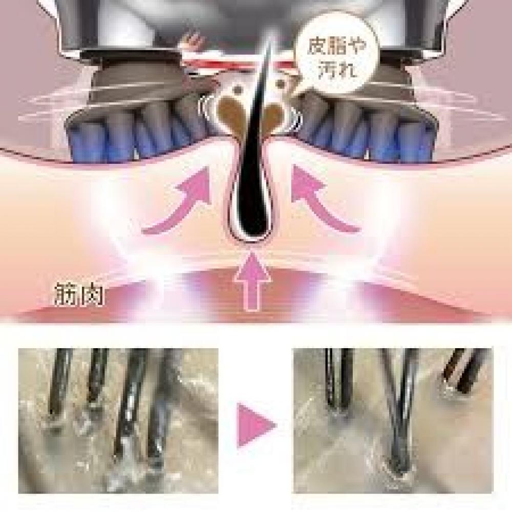 パワフルな回転&EMSトレーニングで汚れを除去！！