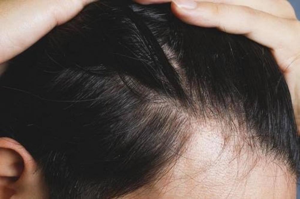 今日からできる！抜け毛予防のヘアケア習慣
