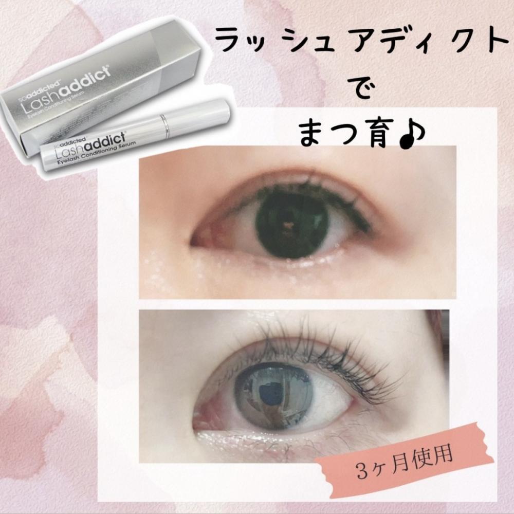 【アフターケア②】まつげ美容液