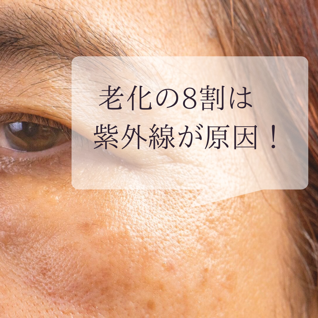 老化の8割は紫外線が原因！