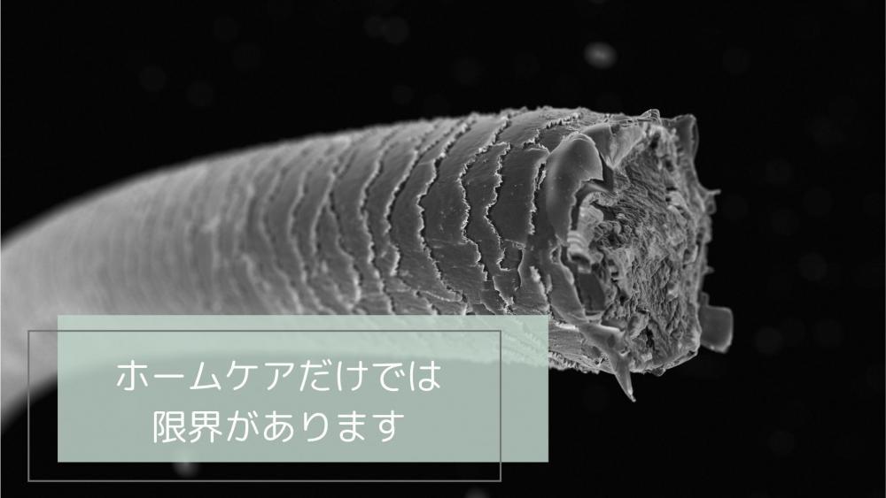 ホームケアだけでは限界がある