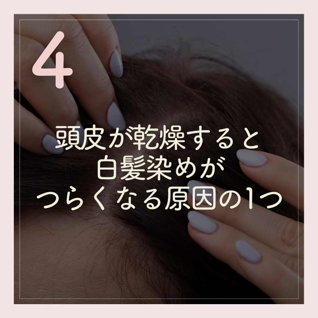 頭皮が乾燥すると、白髪染めがつらくなる原因の1つ