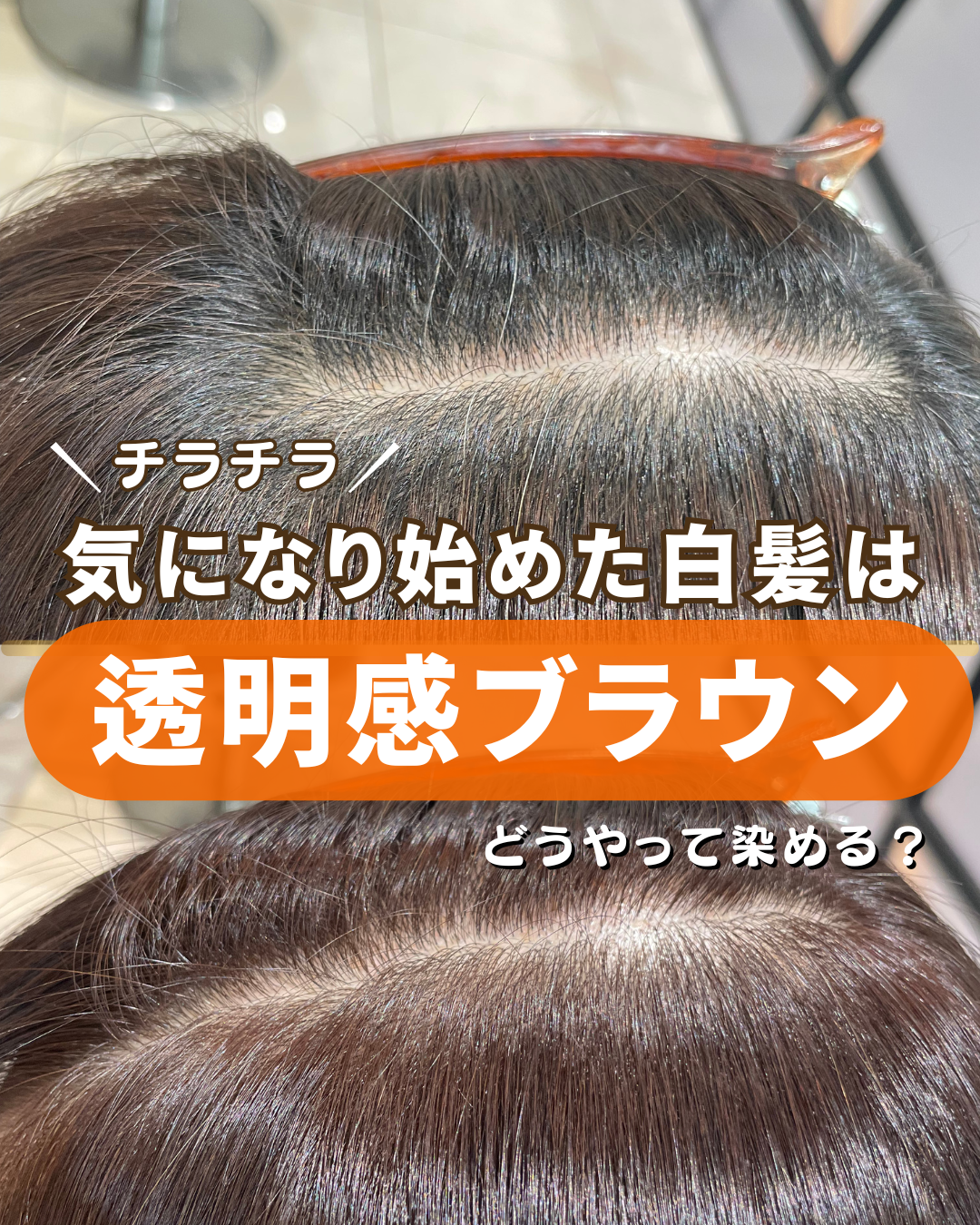 チラチラ気になる白髪、どうする？