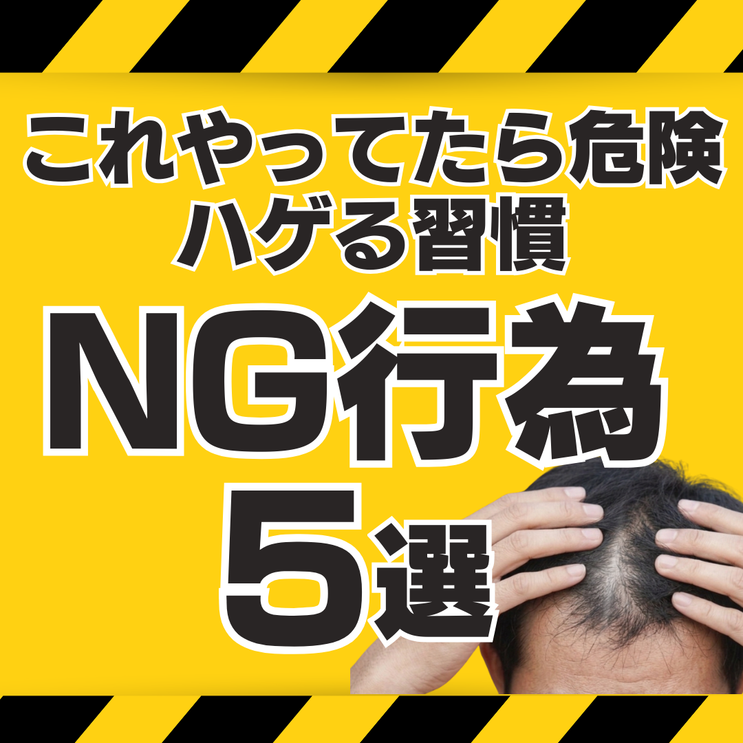 【警告】これやってたら危険！ハゲる習慣5選‼︎改善する方法も解説します♪