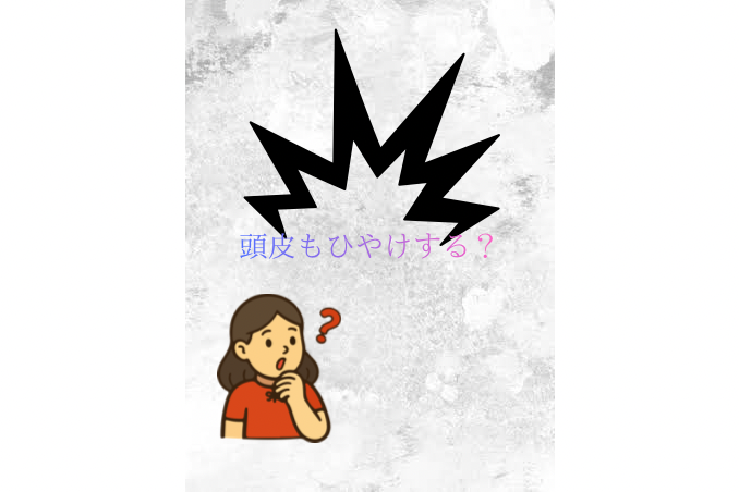 ③頭皮も日焼けする