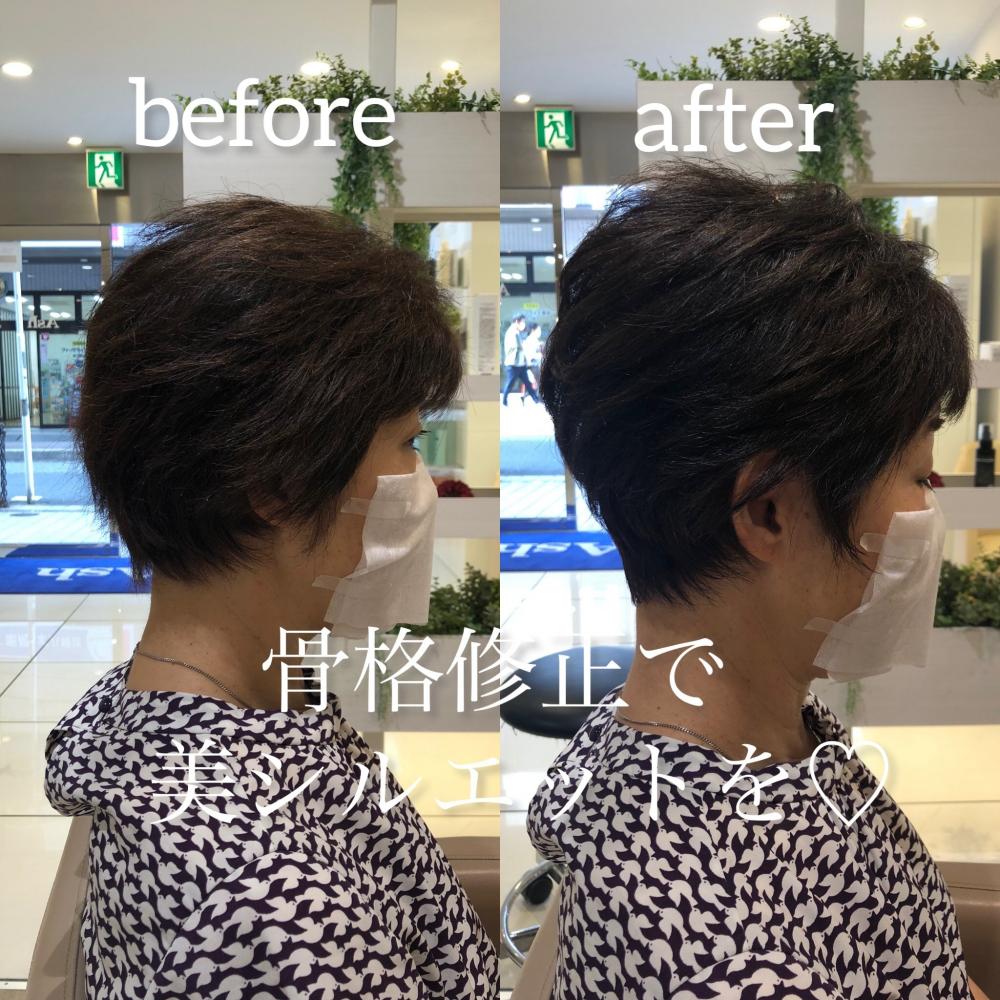 骨格修正コンパクトショート
