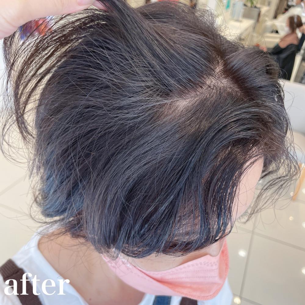 白髪率4〜5割×白髪ぼかし2回目さん｜サブ写真③