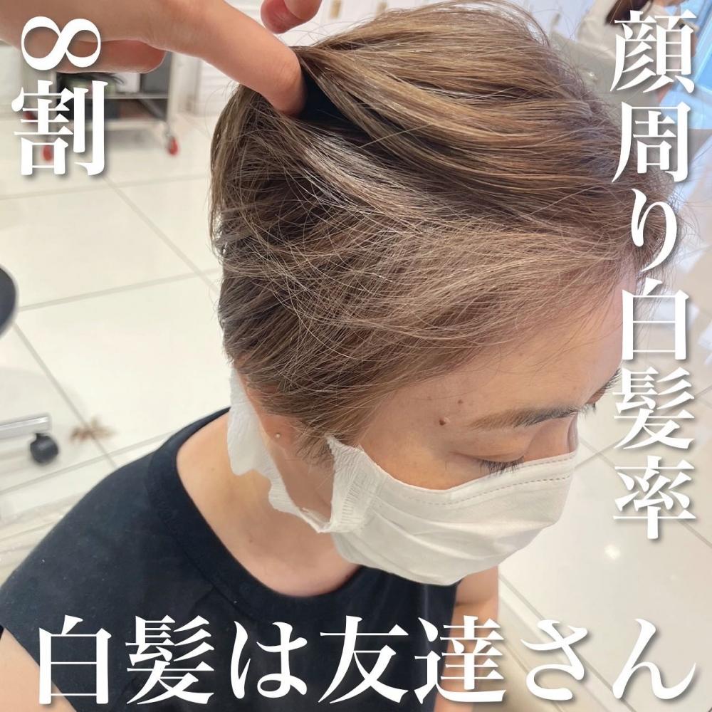 顔周り白髪率８割×白髪は友達さん