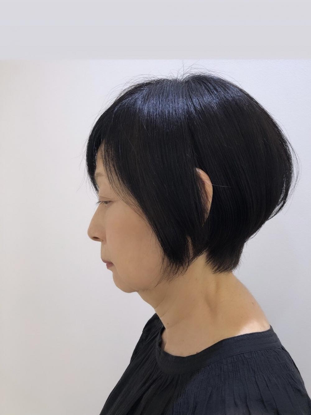 ショート
